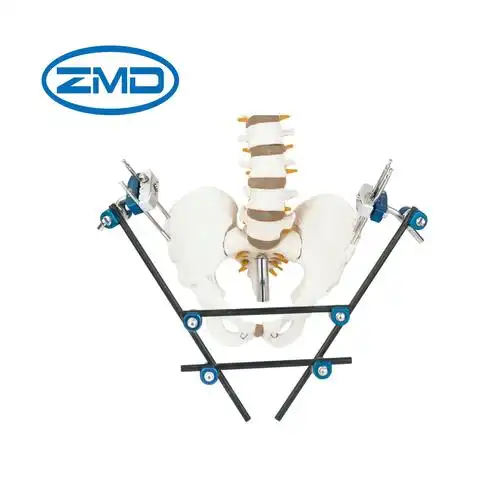 骨盆外固定支架