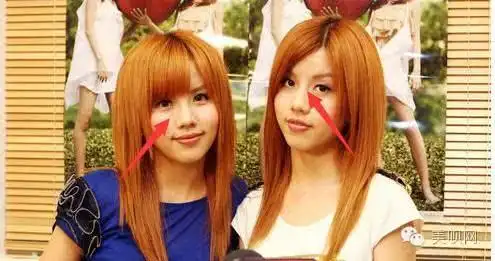 by2走上了蛇精脸之路越来越不像双胞胎整形最高境界我服