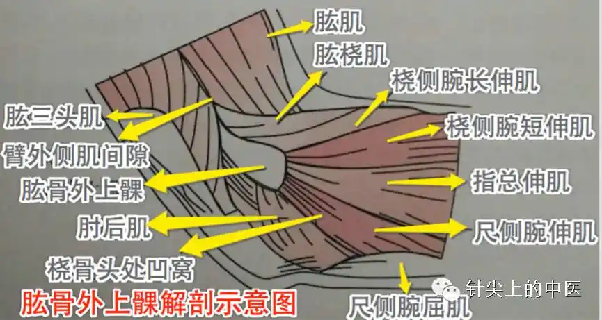 中医炁针实战肘关节损伤