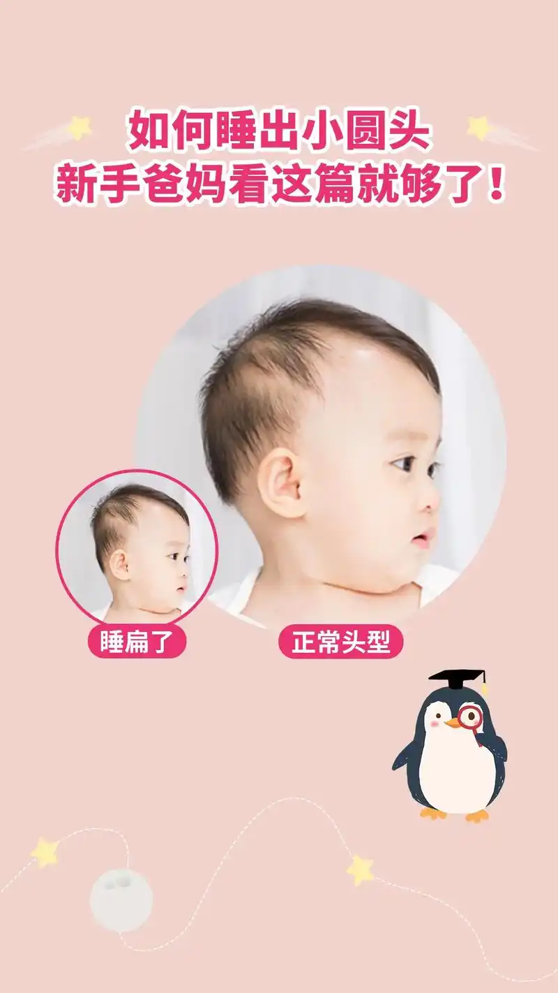 不用着急,看完这篇,教你怎么给宝宝睡圆头.#新手妈妈 #育 - 抖音