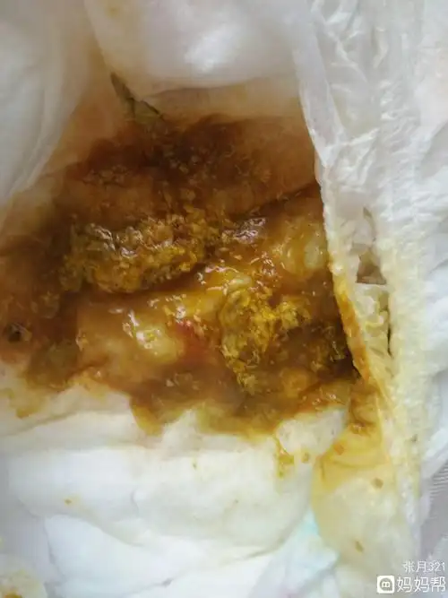 检查大便ob是什么意思(大便常规加ob检查什么)