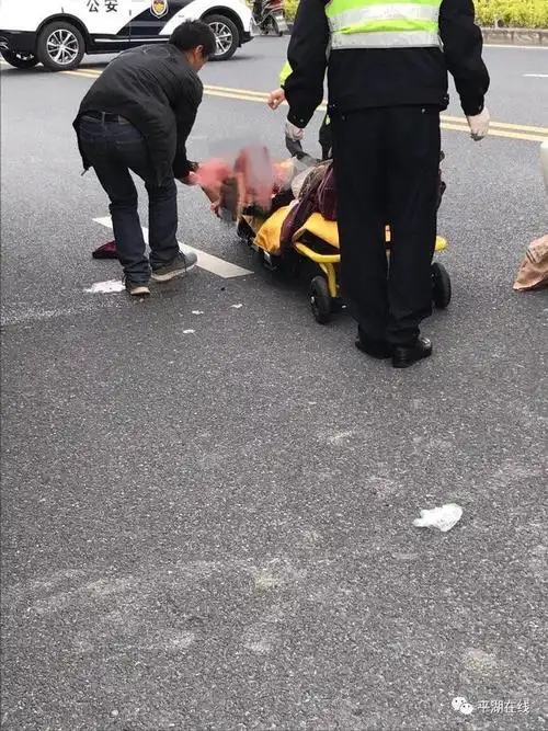 太作孽了平湖突发惨烈车祸一女子腿被大货车当场碾断