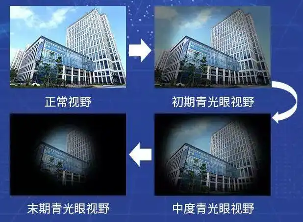 世界青光眼日丨青光眼不胜防高危人群应早设防