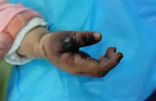 3岁女孩在家中触电身亡,导致悲剧的竟是