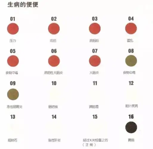 除了痔疮,肛门出血,还有溃疡性大肠炎,霍乱,直肠癌等也会让便便的颜色