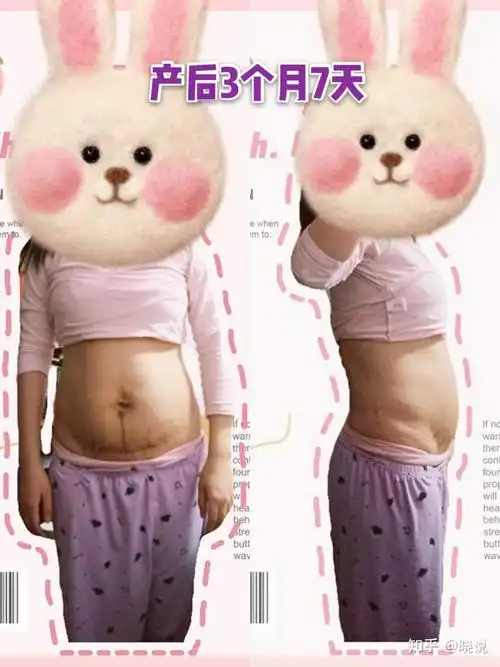 女人生完孩子后肚子的真实状态是怎样的?