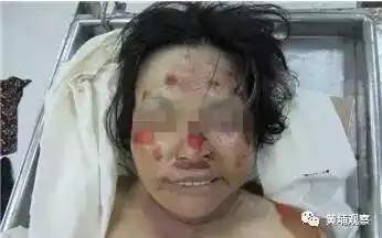 紧急扩散!50岁女子一周前被撞身亡,黄埔警方呼吁家属尽快认领!