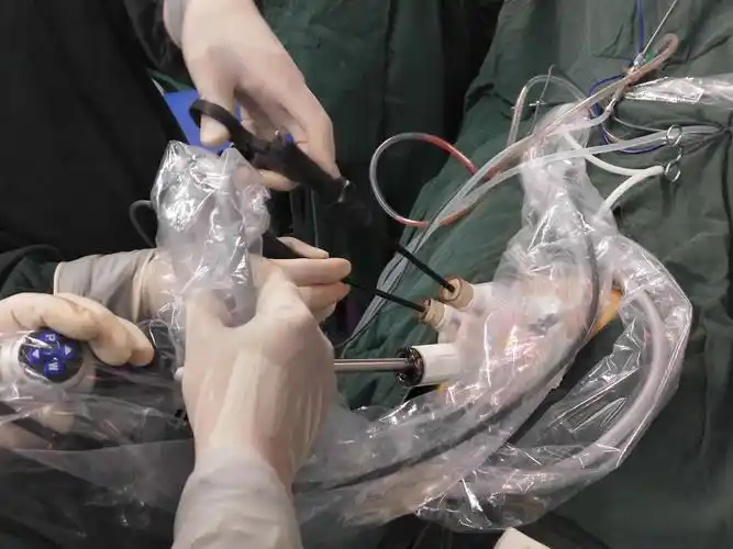 铁力市医院李国彬应用lagiport单孔腹腔镜穿孔阑尾切除术