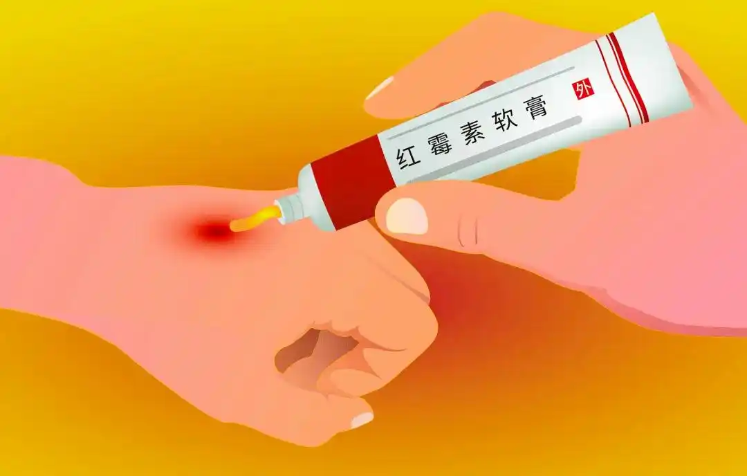 回家后感觉眼睛有些疼痛,去厕所照镜子,发现自己的眼睑部位又红又肿