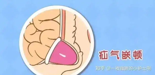 疝气为何最偏爱老年男性