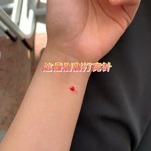 肺结核皮试伤口变化过程