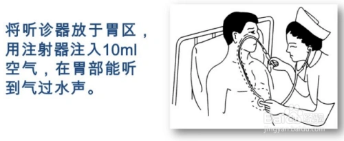 插胃管时测量长度的正确方法