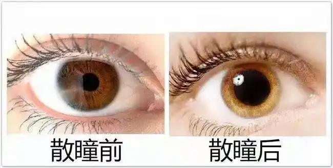 科普】眼睛为什么要" 散瞳"呢?_瞳孔_医生_检查