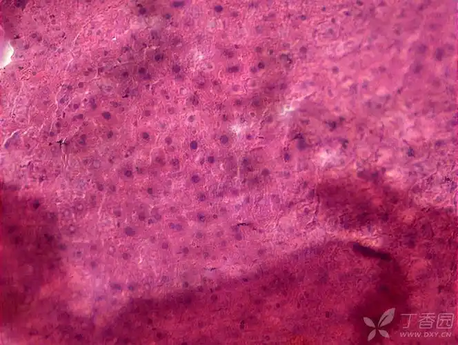 求助!小鼠肝组织病理切片,不知道什么原因,看不太清细胞