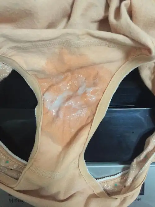 内裤这两天总是这样湿哒哒的,白带也很多,是怎么回事?