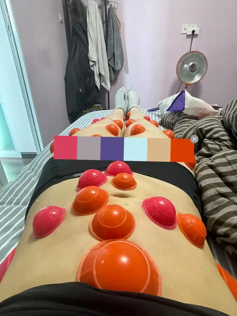 拔罐减肥瘦了30斤的心得总结 以下减肥的心得,不管是不是拔罐减肥都