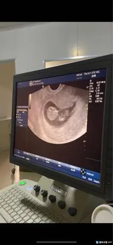 [试管婴儿]孕10周 1,宝宝在肚子里活蹦