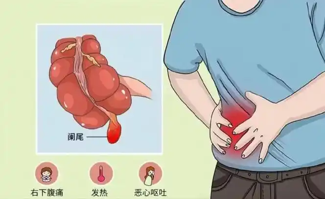 这个孩子最后阑尾脓肿了|急性阑尾炎|儿童|阑尾炎_新浪新闻