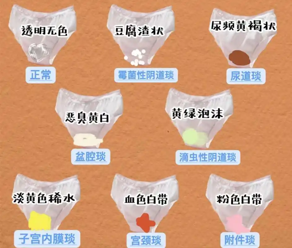 在两次月经中间(即排卵期),白带量多,透明,像蛋清样具有黏性并能拉成