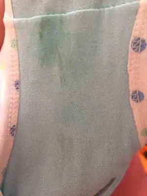 6岁小女孩内裤有绿色分泌物,去医院看了也不见好,有谁家宝妈小孩跟我