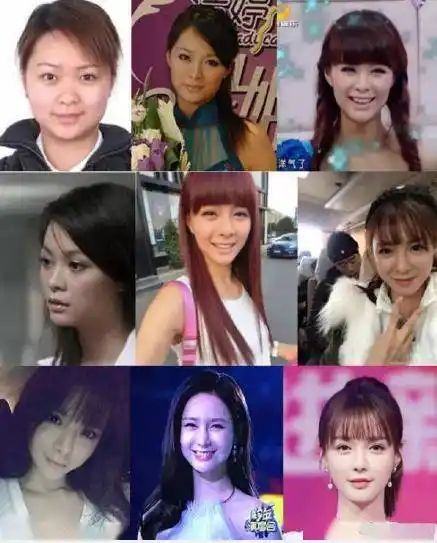 其实沈梦辰整容这个话题一直存在,此前还有网友整理出变化对比照,正面