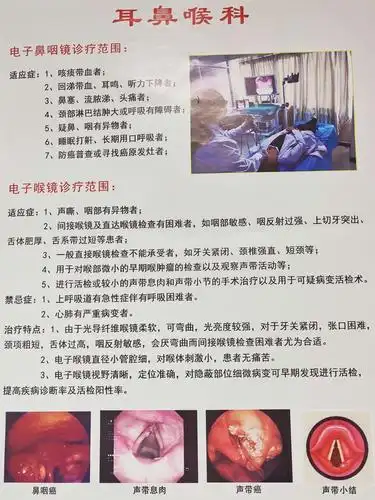 奥林巴斯cv-170电子鼻咽喉镜耳鼻喉科医生的"第三只眼睛"