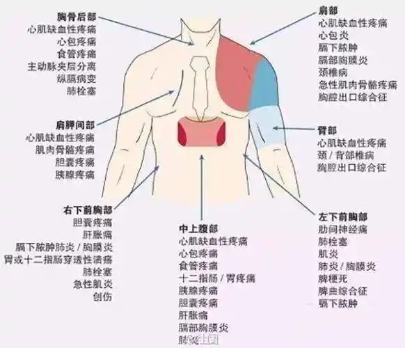 只要是胸痛,就是冠心病心绞痛? - 好大夫在线