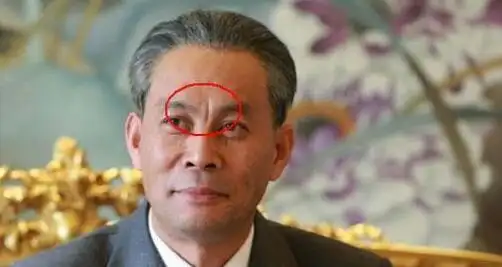 印堂悬针纹是大凶之兆吗?