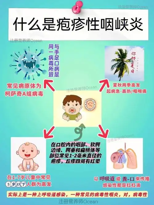 感染了疱疹性咽峡炎,怎么办?丨家长收藏