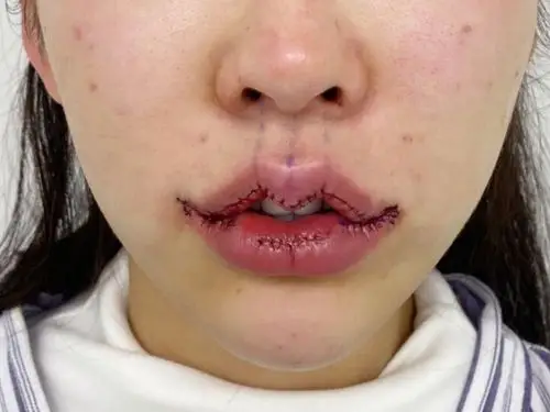 很喜欢嘟嘟唇,性感又可爱.