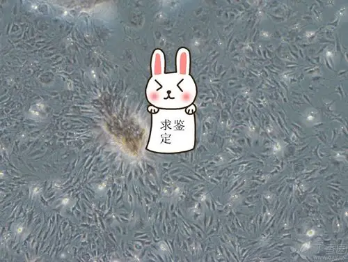 【求助】请各位大神帮我看看我的成骨细胞茜素红染色成功吗?