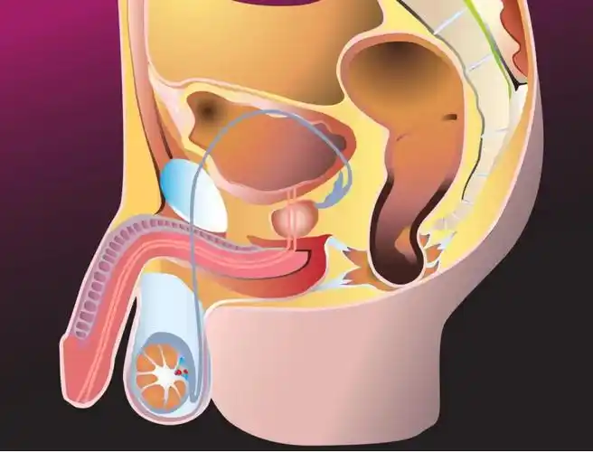 尿道炎的发病症状