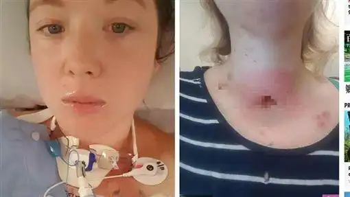 切水果滑倒刀子刺进喉咙,澳洲孕妇躲死劫顺利生女!