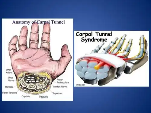 anatomy of carpal tunnel