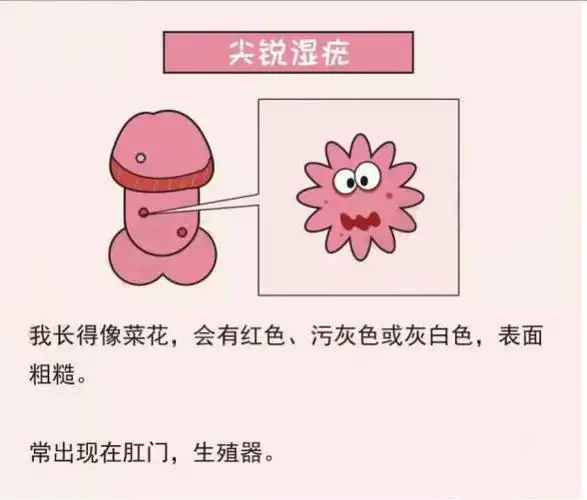 阴茎长了小点点是什么东西