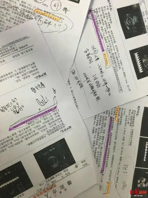 三甲医院产检生下畸形儿父拒带回 医院:诊疗规范