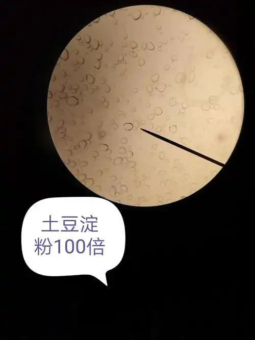 一颗颗淀粉粒(土豆),很清晰