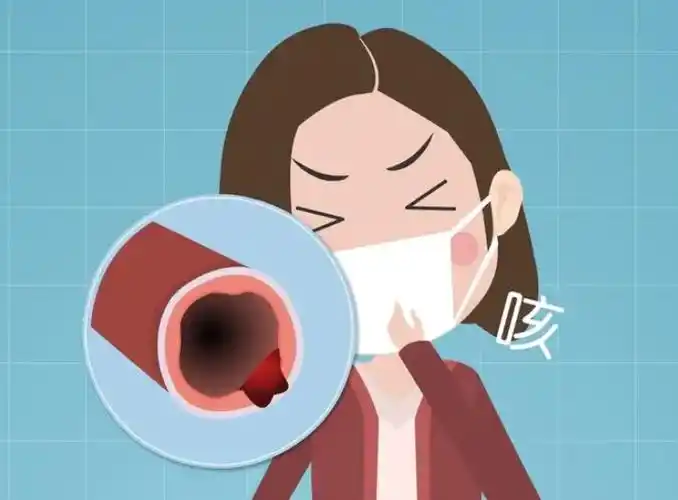 西安莲湖秦华中医医院薛敬东支气管炎一般多久能好