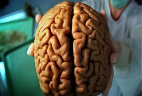 1955年爱因斯坦的大脑被偷走,30年后他聪明的秘密被发现