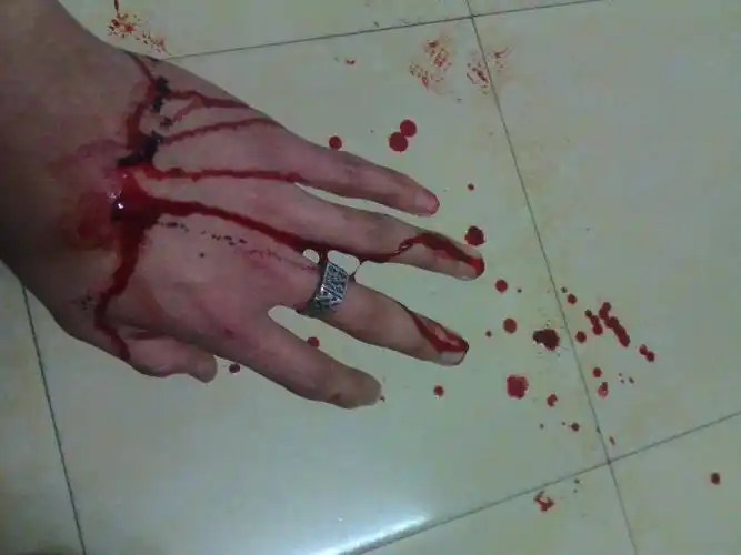 怎样自残不痛?-图片大观-奇异网