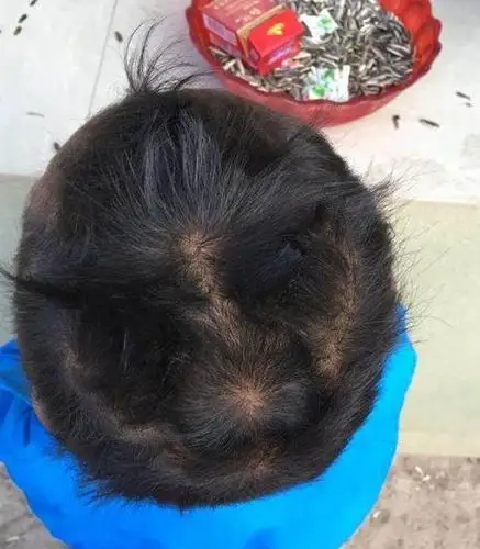 有的宝宝头上有两个发旋,有的只有一个,这是为什么