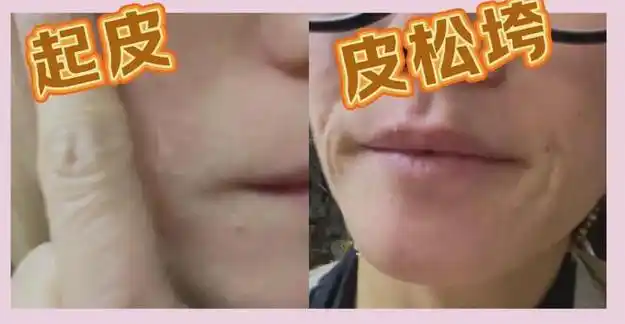 网易首页>网易号>正文申请入驻> 看她刚用完的时候皮肤很明显水灵了不