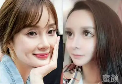 怎么区分整容网红脸和天然脸,其实看这6个地方就知道了!-蜜颜优惠