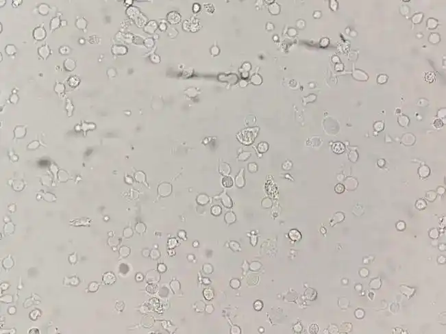 原来你是这样的l|细菌|细胞|镜检|白细胞|细胞壁_网易订阅