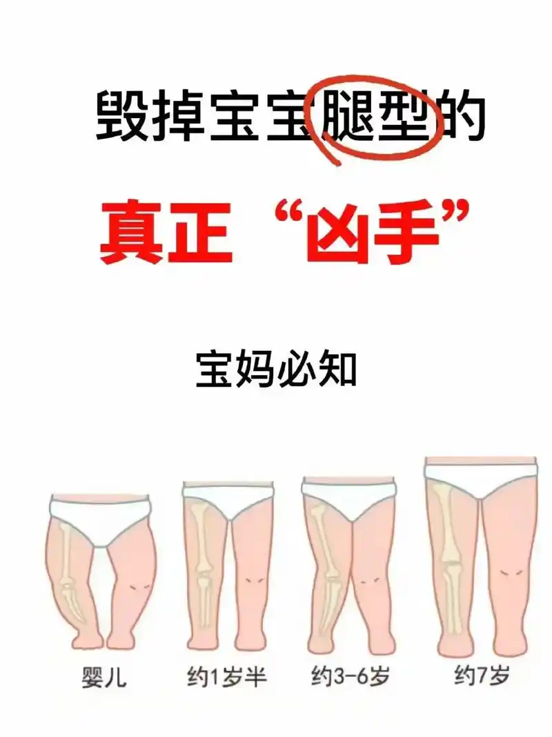 毁掉宝宝腿型的真正凶手,宝妈必知.新生儿期宝宝的腿有点 o  - 抖音
