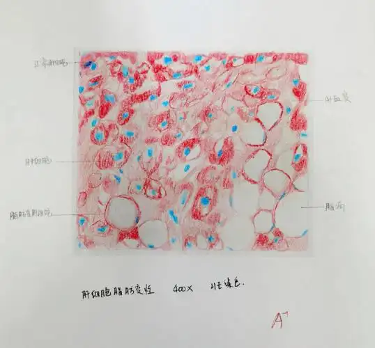 病理切片绘图红蓝铅笔上集