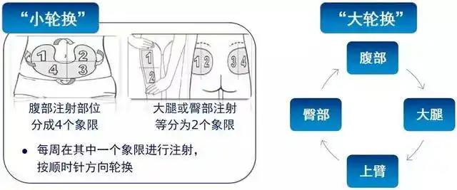 其中,腹部是最适合注射胰岛素的部位,吸收率可达到100%;其次是上臂