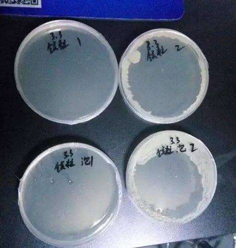 菌落总数测定平板上长出一圈菌落