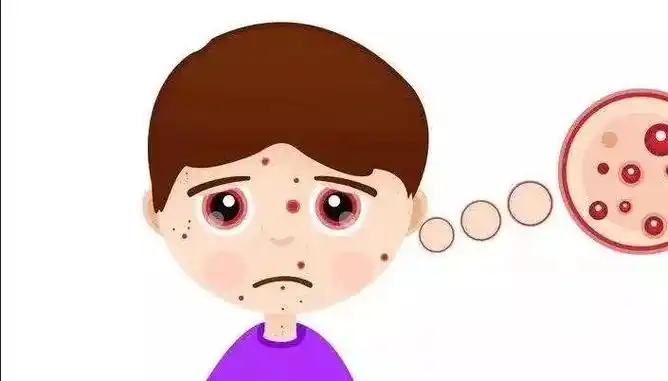 儿童牛皮癣如何的诊断自贡专家告诉你