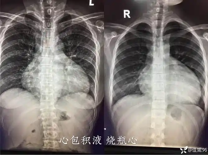 2402神经影像病例